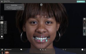 Smile simulation