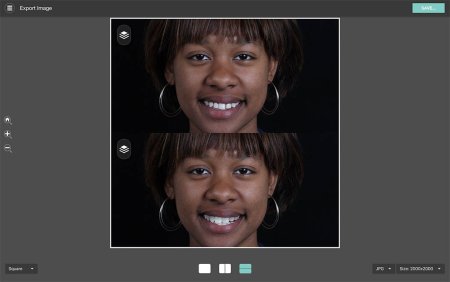Before & After