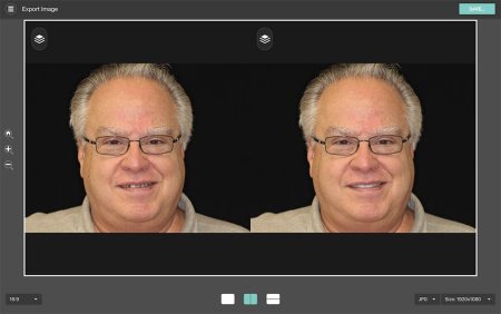 Before & After