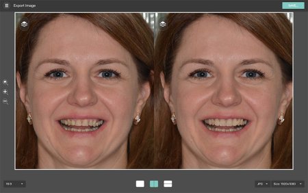 Before & After